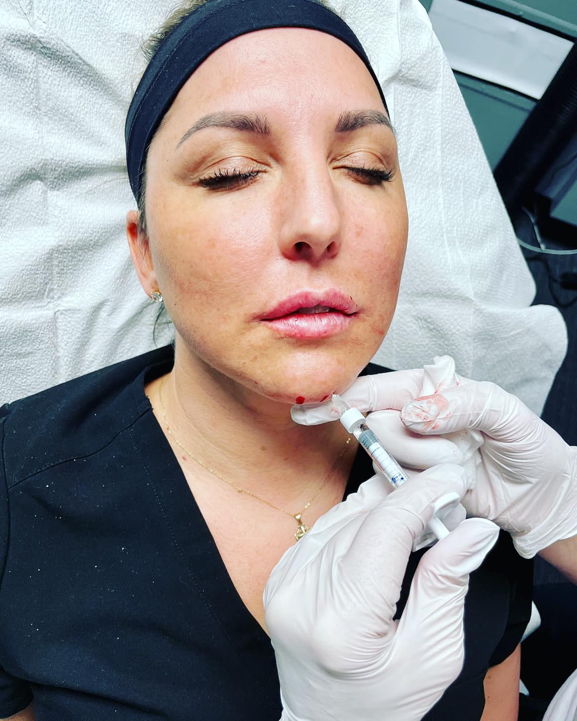 What are the most popular medical spa services 2022?